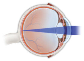normal_refraction